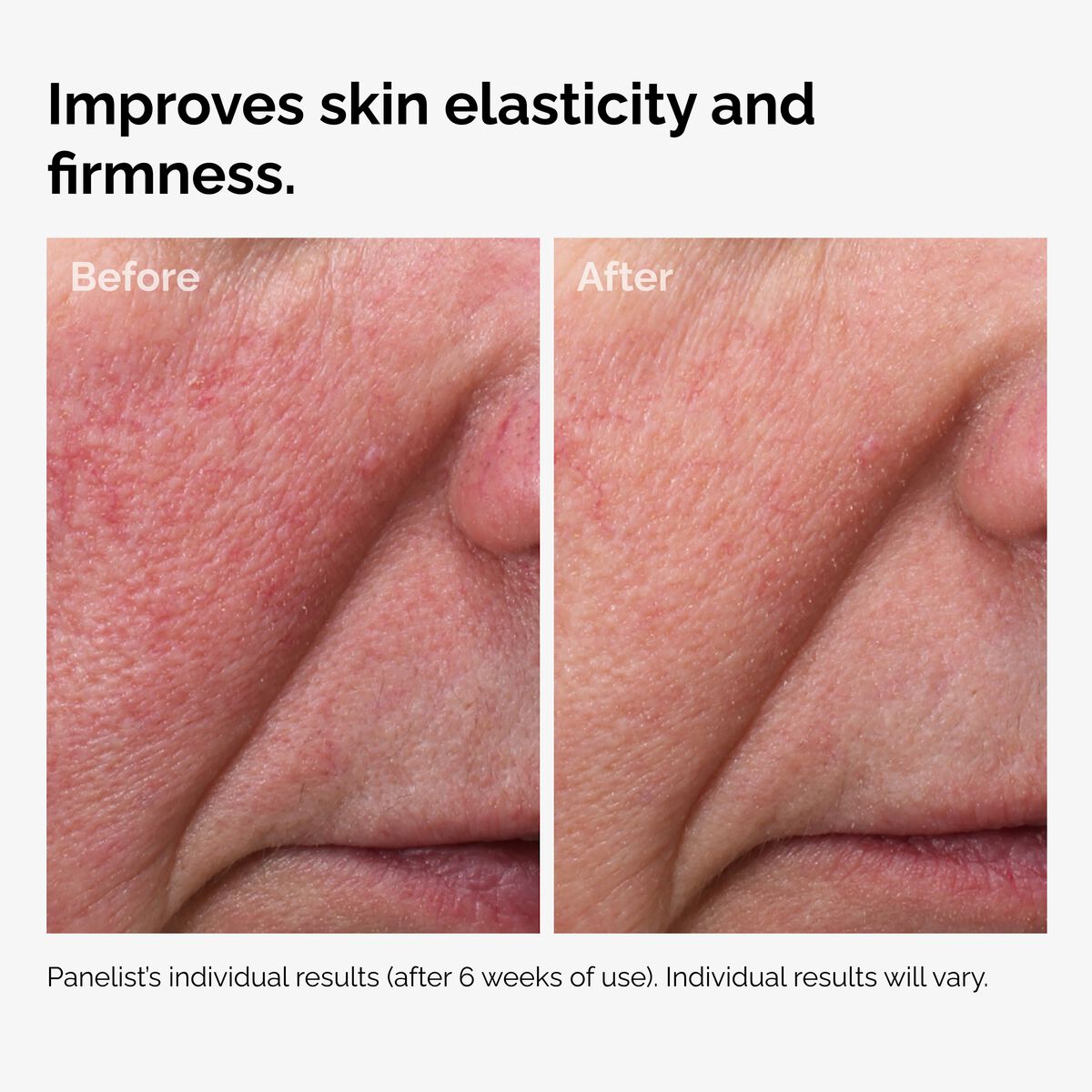 100% Fermented Rose Hip Seed Oil - Skin Support
