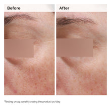 5% Face and Body Emulsion - Hair Care