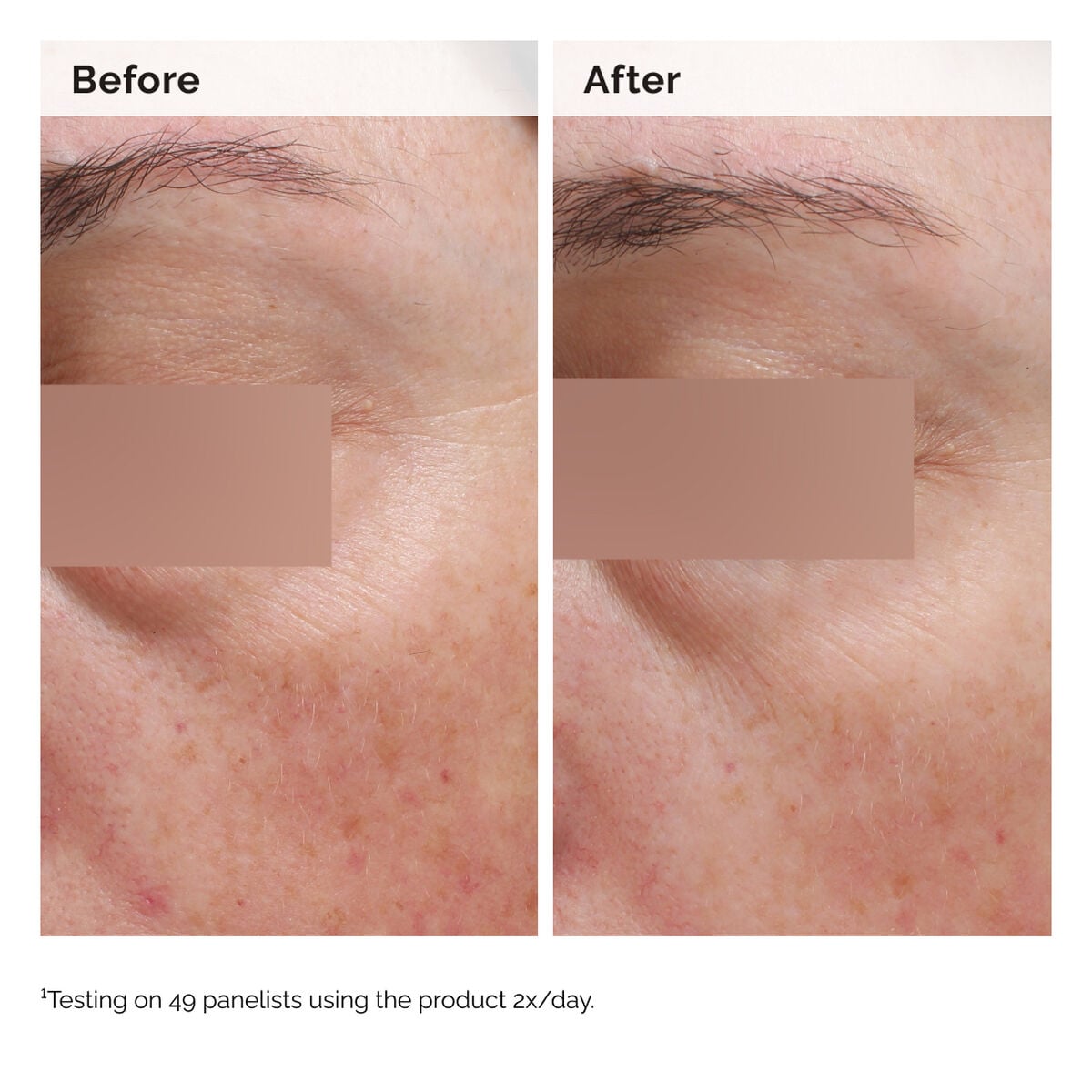 5% Face and Body Emulsion - Hair Care