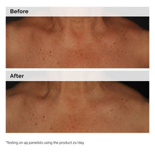 5% Face and Body Emulsion - Hair Care