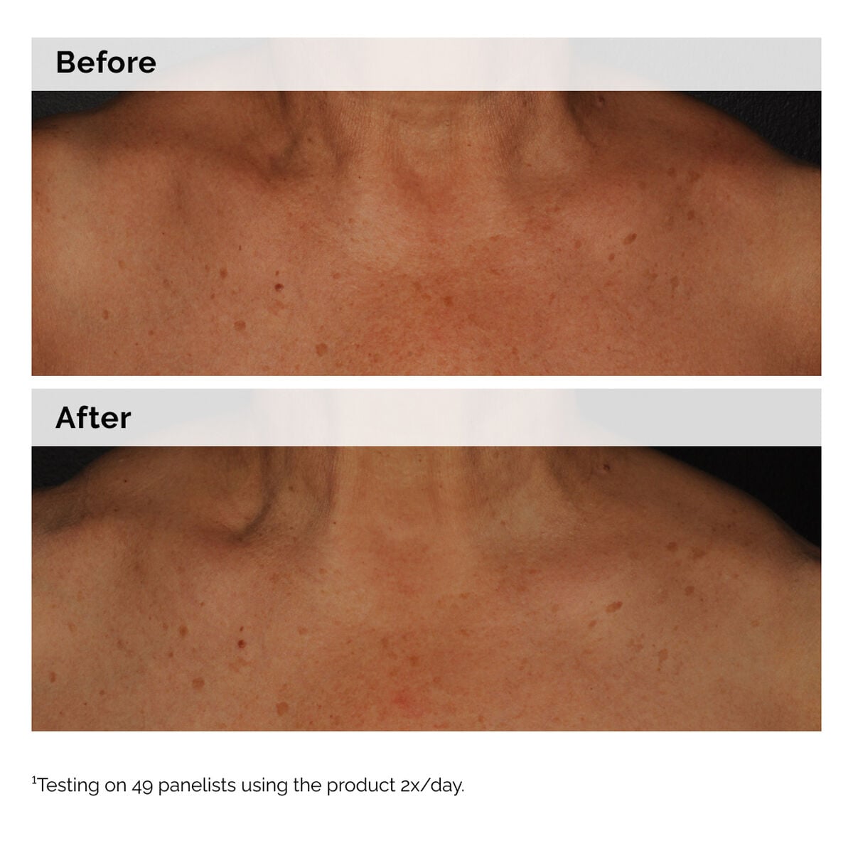 5% Face and Body Emulsion - Hair Care