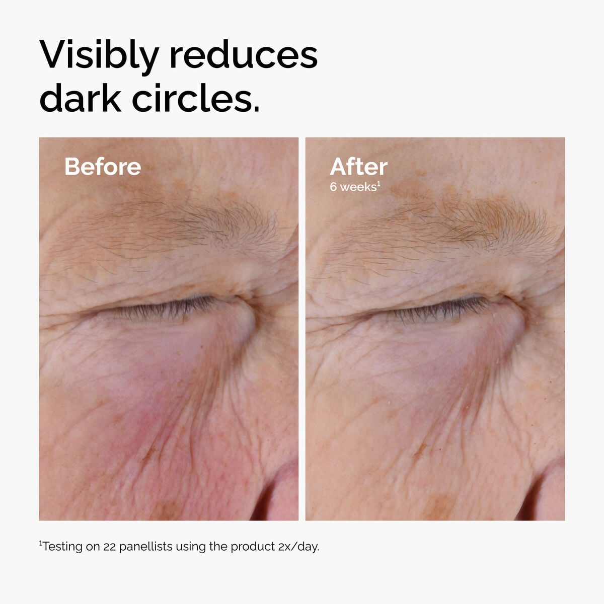 5% + EGCG Eye Serum - Classic Pick