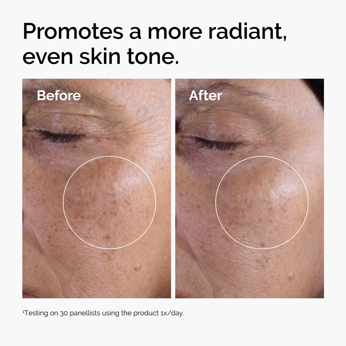 Acid 7% Exfoliating Toner - Classic Pick