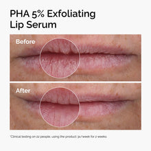 PHA 5% Exfoliating Lip Serum - Classic Wear